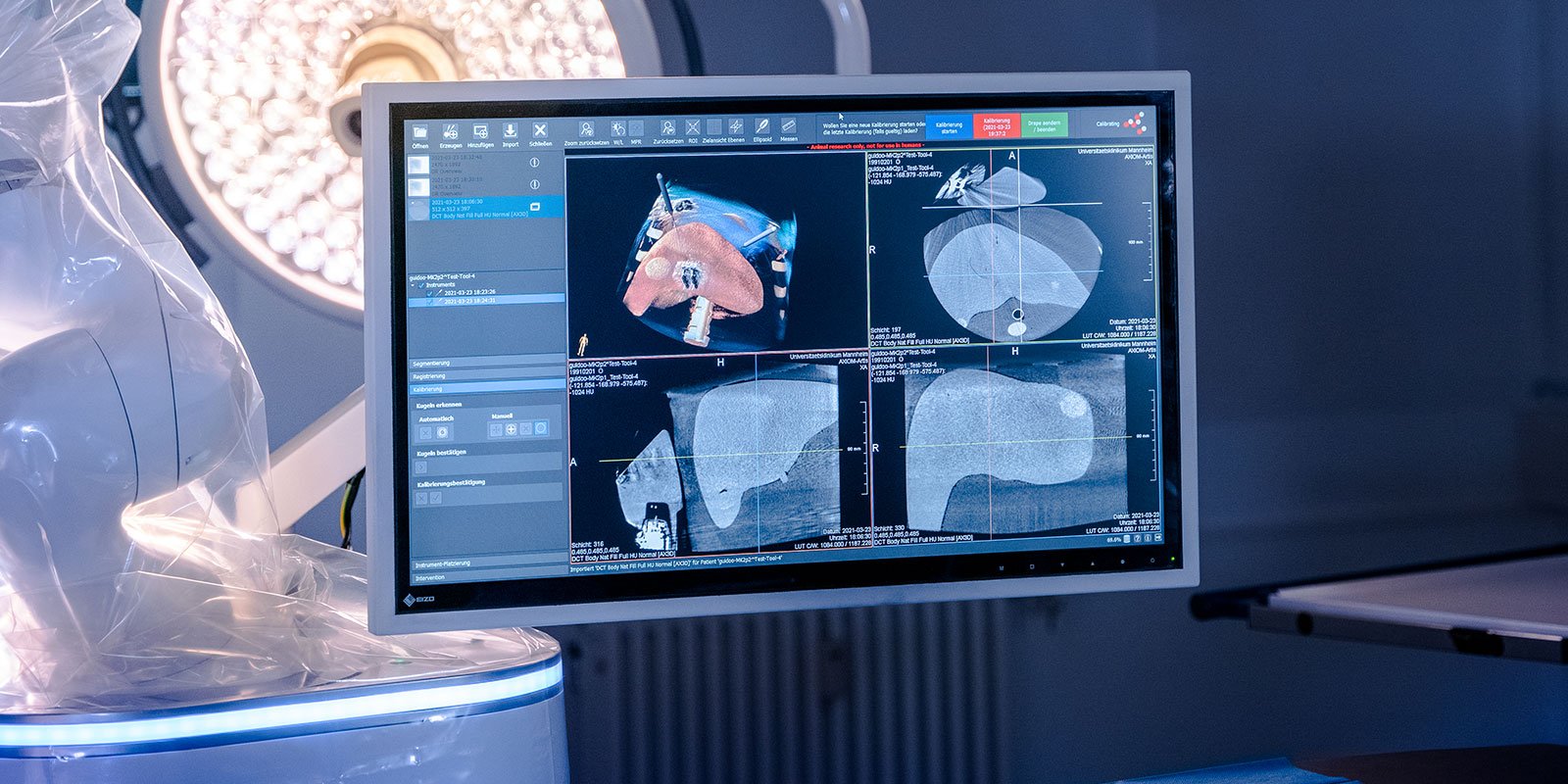 BEC Robotics, KUKA, Ablation, Roboter, robotischer Assistent, perkutane Biopsien, Interventionen, Präzision, medizinisches Fachwissen, Positionierung von Nadeln.